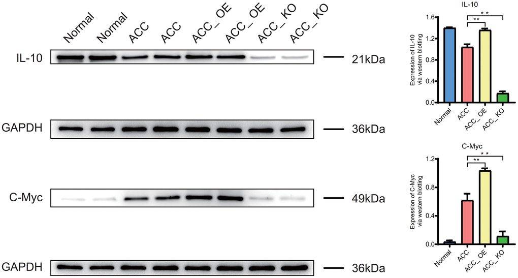 Western blotting. Expression of IL-10 and C-Myc proteins in ACC group.
