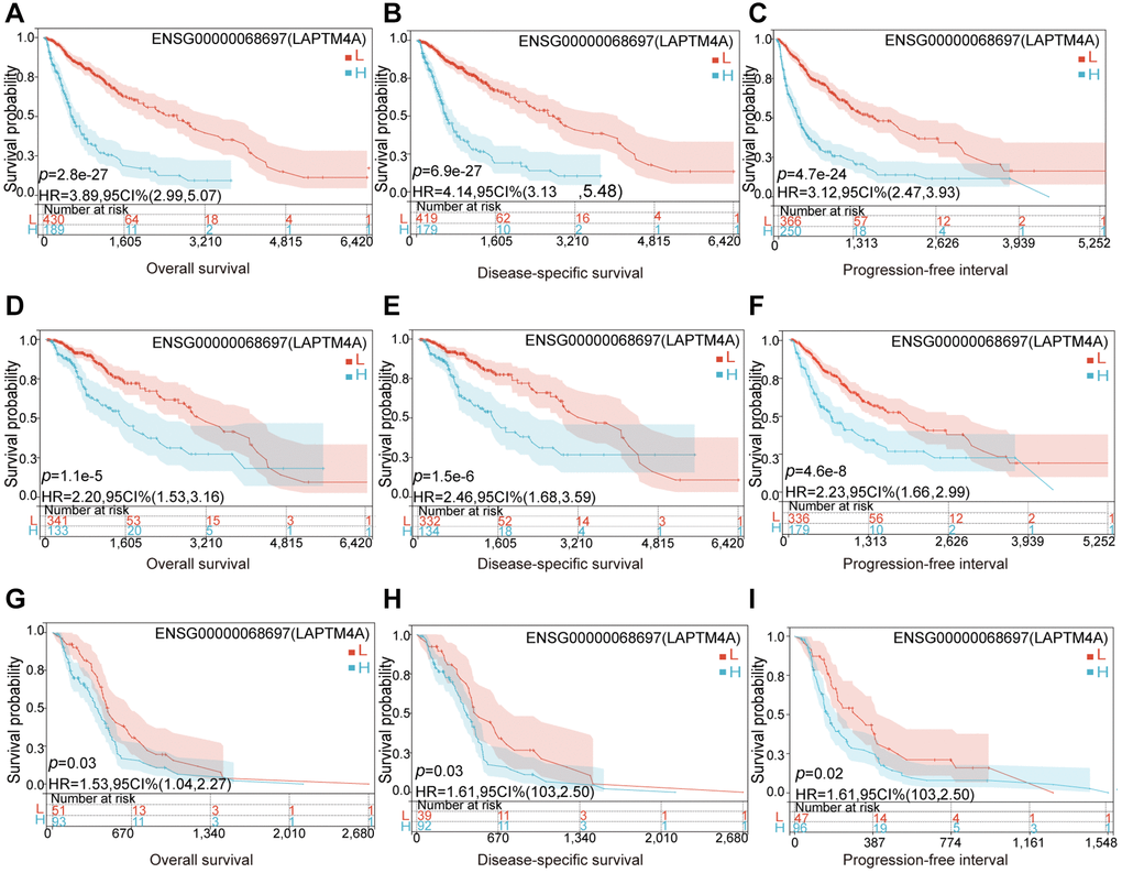 Relationship between LAPTM4A and prognosis of glioma patients. LGG patients with higher expression levels of LAPTM4A had unfavorable (A) OS, (B) DSS, and (C) PFS. GBMLGG patients with higher expression levels of LAPTM4A had awful (D) OS, (E) DSS, and (F) PFS. GBM patients with higher expression levels of LAPTM4A had undesirable (G) OS, (H) DSS, and (I) PFS.