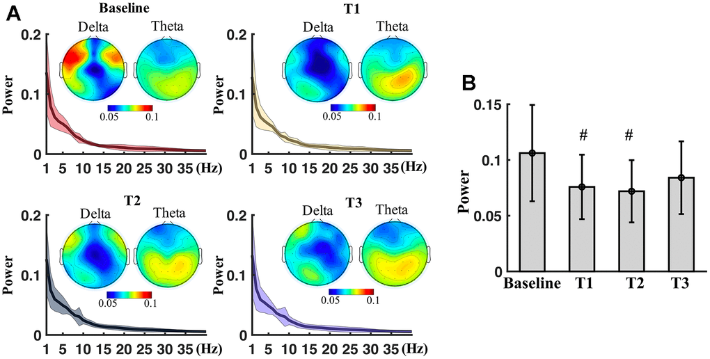 Spectral power measured at different time points. (A) Spectrum power (mean ± SD) averaged from all electrodes at baseline, T1, T2 and T3. Topography shows spatial distribution of delta and theta power at the time points. (B) Boxplots of the average power of delta of frontal region at baseline, T1, T2 and T3. # means significance before multiple comparison correction but non-significance after correction.