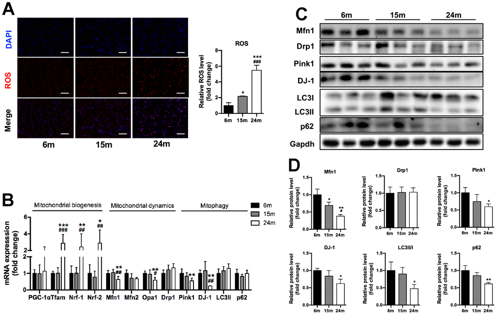 Increased ROS production and altered mitochondrial regulators of SM in mice during aging. (A) Representative ROS fluorescence staining of Ga muscles and quantification, Scale bar: 100 μm, n=3; (B) mRNA levels of mitochondrial biogenesis, mitochondrial dynamics and mitophagy/autophagy-related markers, n=7; (C) Representative Western blots and (D) quantification of Mfn1, Drp1, Pink1, DJ-1, LC3II/I, p62 and Gapdh (loading control), n=3. *p