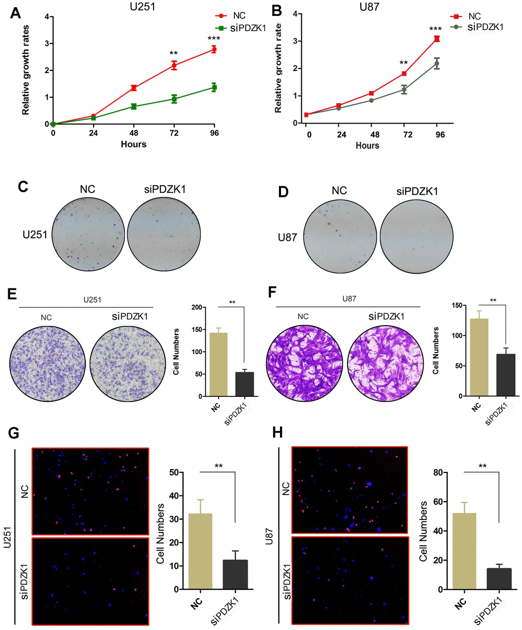 PDZK1 knockdown inhibits the proliferation and invasion of glioma cells. (A, B) The effect of PDZK1 knockdown on U251 and U87 cell proliferation was assessed by the CCK-8 cell growth assay. ***P C, D) The effect of PDZK1 knockdown on U251 and U87 cell proliferation was assessed by a colony formation assay. (E, F) Transwell assays were used to detect the inhibitory effect of PDZK1 knockdown on invasion in U251 and U87 cells. **P G, H) Knockdown of PDZK1 inhibited DNA replication in U251 and U87 cells, as determined by EdU staining. **P 