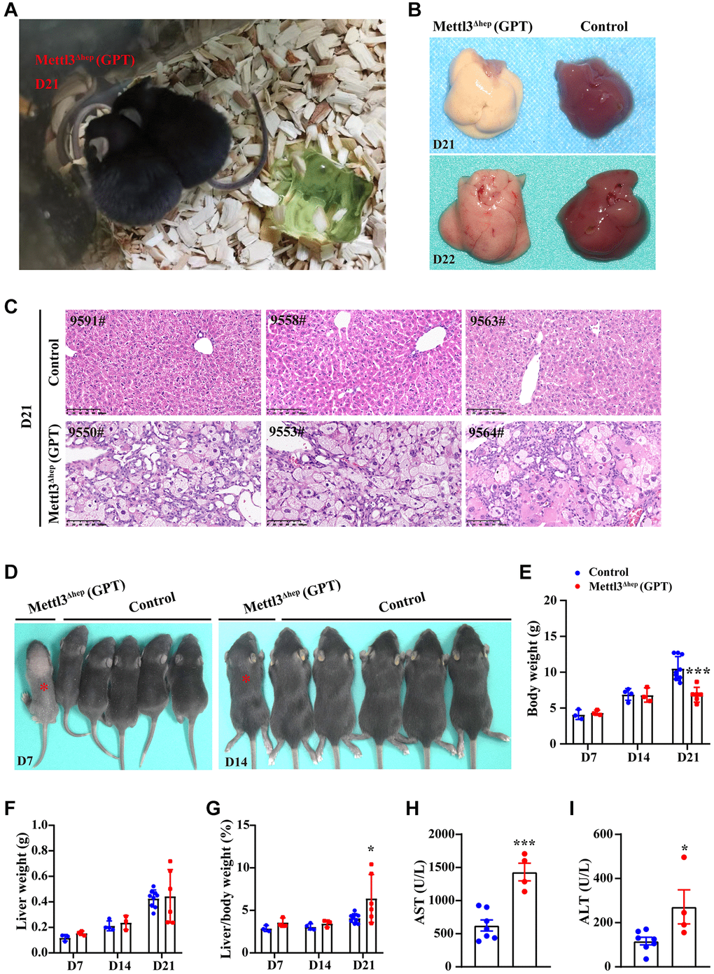 Homozygous deletion of METTL3 in murine hepatocytes by Alb-iCre mice (GPT) results in liver injury and acute liver failure (ALF). (A) Representative appearance of METTL3Δhep mice (GPT) at 21 days after birth. (B) Representative gross appearance of livers from control mice and METTL3Δhep mice (GPT) at 21 or 22 days postnatally. (C) Representative H&E staining photographs of liver sections from control mice and METTL3Δhep mice (GPT) at 21 days postnatally. Scale bar = 100 μm. (D) Representative appearance of control mice and METTL3Δhep mice (GPT) at 7 or 14 days after birth. (E–G) Body weight (E), liver weight (F) and liver-to-body weight ratio (G) of control mice and METTL3Δhep mice (GPT) at 7, 14 or 21 days after birth. (H, I) Serum levels of AST (H) and ALT (I) of control mice and METTL3Δhep mice (GPT).