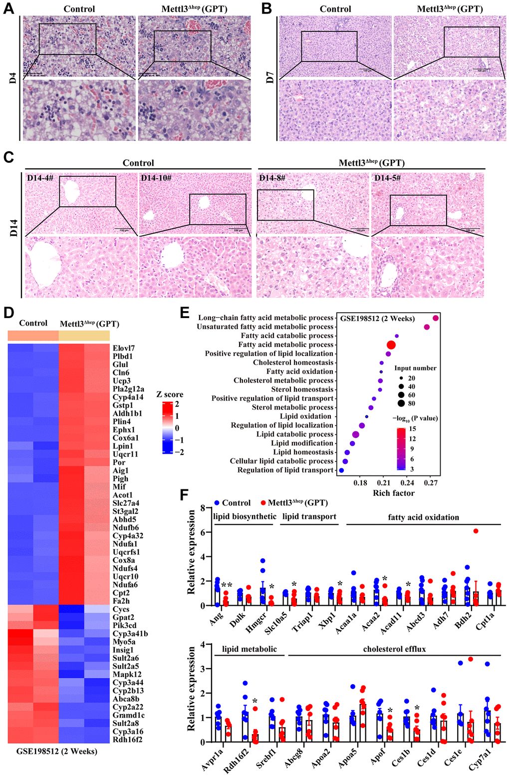 Hepatic METTL3 homozygous knockout by Alb-iCre mice (GPT) induces abnormal lipid accumulation in mouse hepatocytes. (A–C) Representative H&E staining photographs of liver sections from control mice and METTL3Δhep mice (GPT) at 4 (A), 7 (B) and 14 (C) days postnatally. Scale bar = 100 μm. (D) Heatmap depicts the differential expression of hepatic lipid metabolism-related genes from RNA-seq results deposited in NCBI GEO under the accession number GSE198512 [17]. In the cluster heatmap, class comparison and hierarchical clustering of differentially expressed genes (DEGs) involved in hepatic lipid metabolism were performed between control mice and METTL3Δhep mice (GPT) at 2 weeks after birth. Genes with increased and reduced expressions are shown in red and blue, respectively. (E) GO analysis of up- and downregulated genes related with hepatic lipid metabolism (from RNA-seq data deposited in GEO under accession number GSE198512) in the liver of control mice and METTL3Δhep mice (GPT) at 2 weeks after birth. (F) qRT-PCR analysis of the mRNA expression of genes related with to fatty acid oxidation, cholesterol efflux, lipid metabolic process, lipid transport and lipid biosynthetic process in the livers of METTL3Δhep mice (GPT).