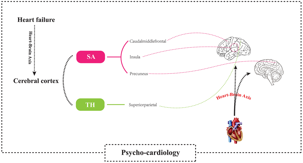 Using a two-sample Mendelian randomization framework, we revealed that heart failure causally influences brain cortical structure alterations, supporting the existence of the “heart-brain axis”. SA, Surficial area; TH, thickness.