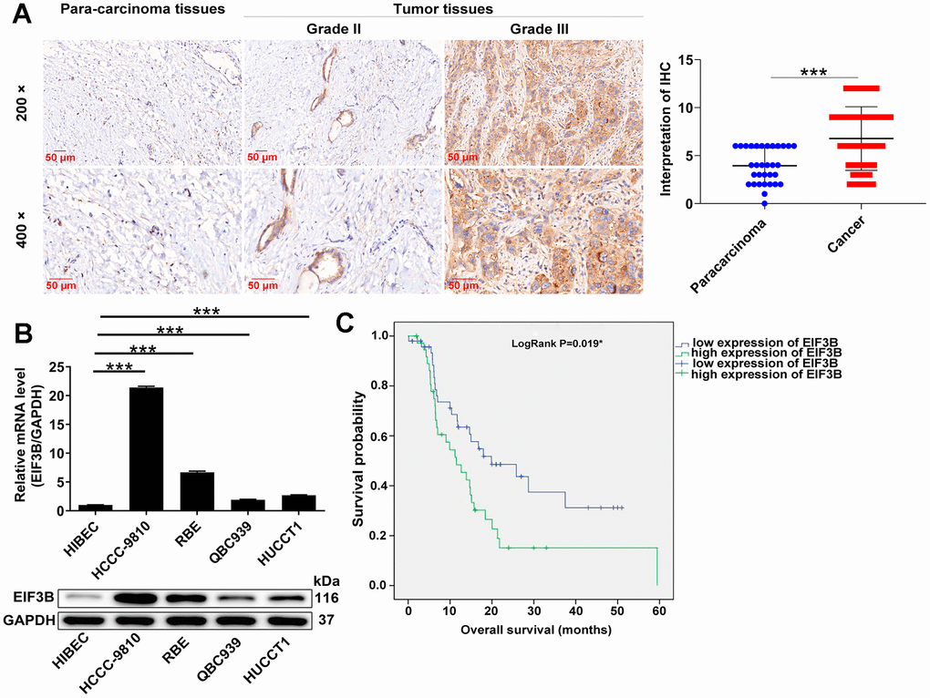 EIF3B was abundantly expressed in cholangiocarcinoma tissues and cells. (A) Typical images and quantitative data illustrations of EIF3B immunohistochemical staining in cholangiocarcinoma tissues and para-carcinoma tissues. Scale bar: 50 μm. Magnification times: 200 ×, 400 ×. (B) EIF3B mRNA and protein levels in cholangiocarcinoma cell lines (HCCC-9810, RBE, HUCCT1, QBC939) and HIBEC cell lines. The experiments were in triplicate. (C) Kaplan-Meier survival analysis was performed to reveal the relationship between EIF3B expression and prognosis of cholangiocarcinoma patients. Results were presented as mean ± SD. *** P 