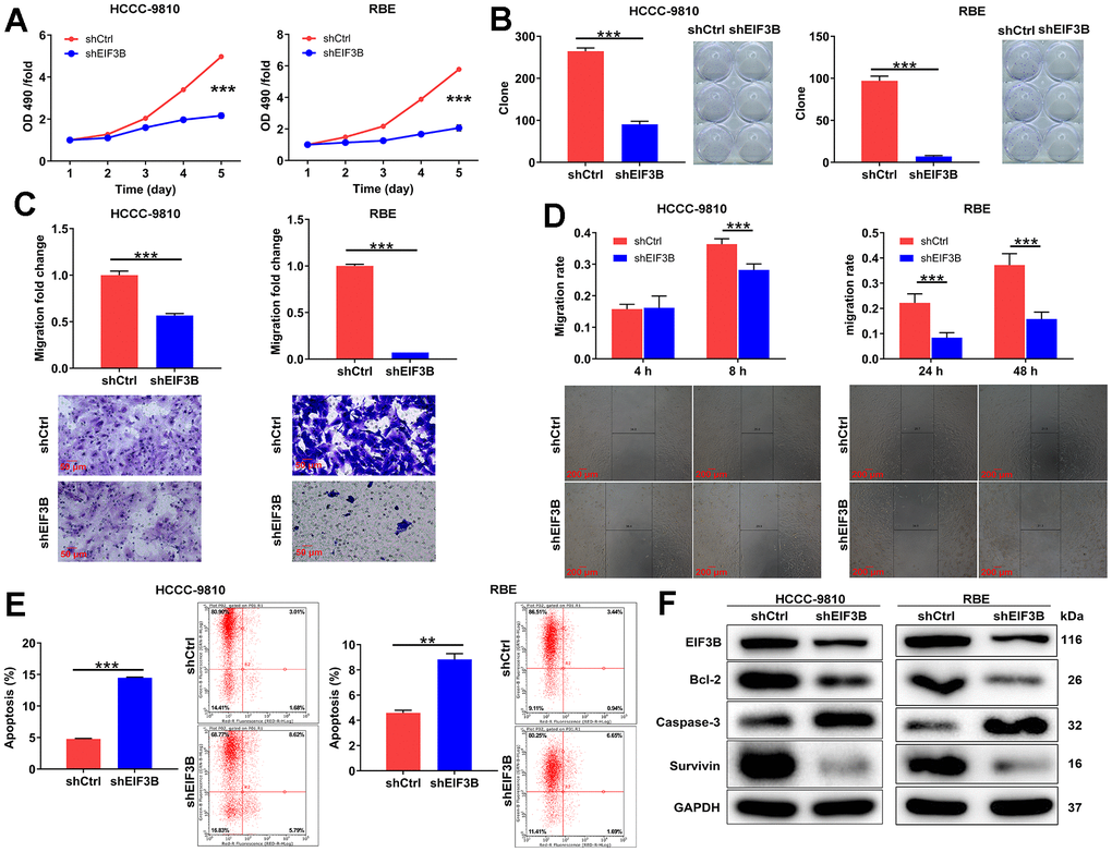EIF3B depletion suppressed cholangiocarcinoma development in vitro. (A) The cell proliferation abilities of HCCC-9810 and RBE cells after being transfected shEIF3B or shCtrl were assessed by MTT assay. (B) After being transfected shEIF3B or shCtrl, the capacities of HCCC-9810 and RBE cells to form colony were detected. (C, D) After being transfected shEIF3B or shCtrl, the changes of cell migration of HCCC-9810 and RBE cells were evaluated by transwell assay (C) and wound-healing assay (D). Scale bar: 50 μm for transwell assay and 200 μm for wound-healing assay. Magnification times: 200 × for transwell assay and 50 × for wound-healing assay. (E) The effects of EIF3B knockdown on cell apoptosis of HCCC-9810 and RBE cells were examined by flow cytometry. (F) The levels of apoptosis-related proteins in HCCC-9810 and RBE cells transfected with shEIF3B and shCtrl were measured by western blot. All the experiments were in triplicate. Results were presented as mean ± SD. ** P P 