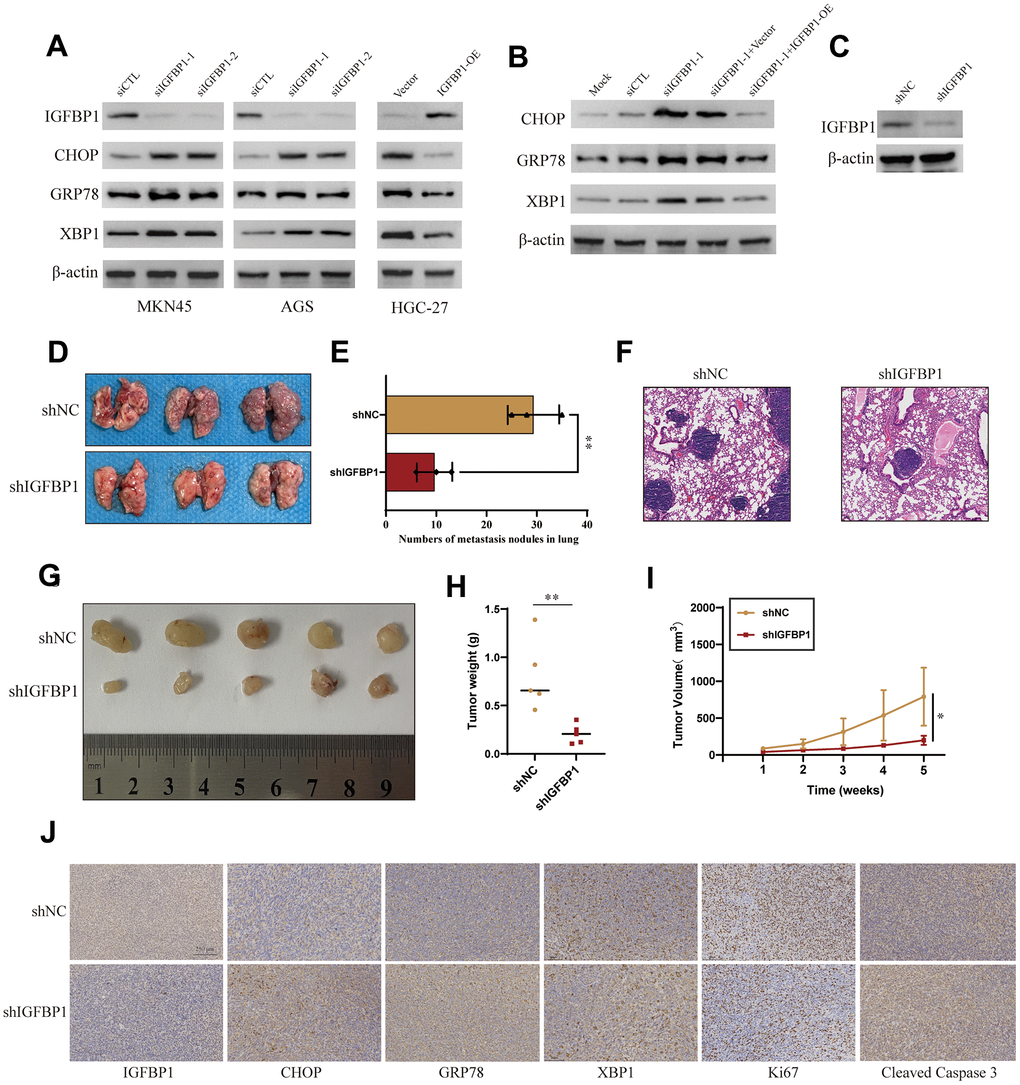 Validation of the role of IGFBP1 in the unfolded protein response of gastric cancer. (A) MKN45 and AGS cells were transfected with siIGFBP1 and overexpressed IGFBP1 in HGC-27 cells. (B) Protein expression changes of CHOP, GRP78, XBP1 after IGFBP1 supplementation in MKN45 cells. (C) Verify knock down efficiency of shIGFBP1. (D) Anatomical images of lung metastases 4 weeks after caudal vein inoculation with gastric cancer cells. Lung metastasis was inhibited in cancer cells transfected with shIGFBP1 compared to shNC. (E) Statistical histogram of pulmonary metastatic nodules. (F) H&E staining in the pathology of lung metastases. (G) Images of xenografts dissected from nude mice 5 weeks after subcutaneous injection. (H) Graph showing the average tumor weight of the resected tumor. (I) Tumor volume curve showing tumor growth. (J) Representative IHC images of the shIGFBP1 and shNC were differentially expressed CHOP, GRP78, XBP1, Ki67 and Cleaved Caspase 3. *P 