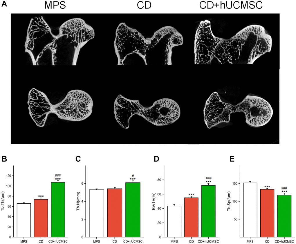 hUCMSCs improved the femoral head microstructure in the MPS-induced ONFH rabbit model. (A) Representative images of Micro-CT of the femoral head in each group; (B–E) Quantitative analysis of Tb.Th, Tb.N, BV/TV and Tb.Sp in each group. The data are presented as the means ± SD (n = 7). *p **p ***p #p ##p ###p 