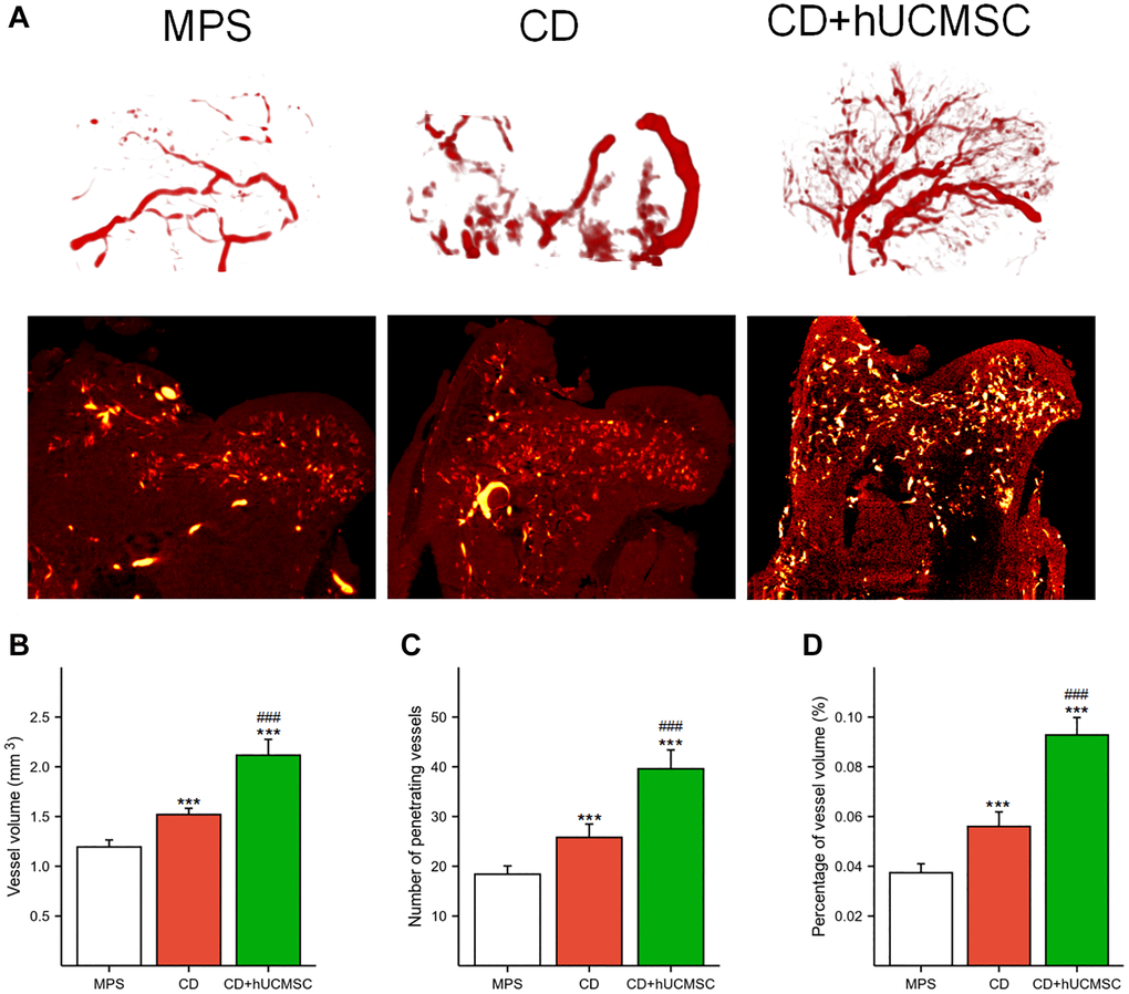 hUCMSCs promoted MPS-induced angiogenesis in the femoral head in a rabbit model of ONFH. (A) Representative microvascular imaging of the femoral head in each group. (B–D) Quantitative analysis of the vessel volume, number of penetrating vessels and percentage of vessel volume. The data are presented as the means ± SD (n = 5). *p **p ***p #p ##p ###p 