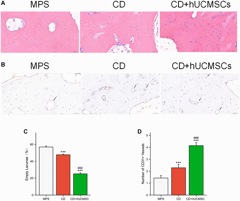 hUCMSCs reduced the incidence of empty lacunae and increased the number of CD31+ microvessels. (A) The bone tissues were analyzed via HE staining. (B) Immunohistochemistry staining of CD31. (C) Quantitative analysis of empty lacunae. (D) Quantitative analysis of the number of CD31+ vessels. The data are presented as the means ± SD (n = 7). *p **p ***p #p ##p ###p 