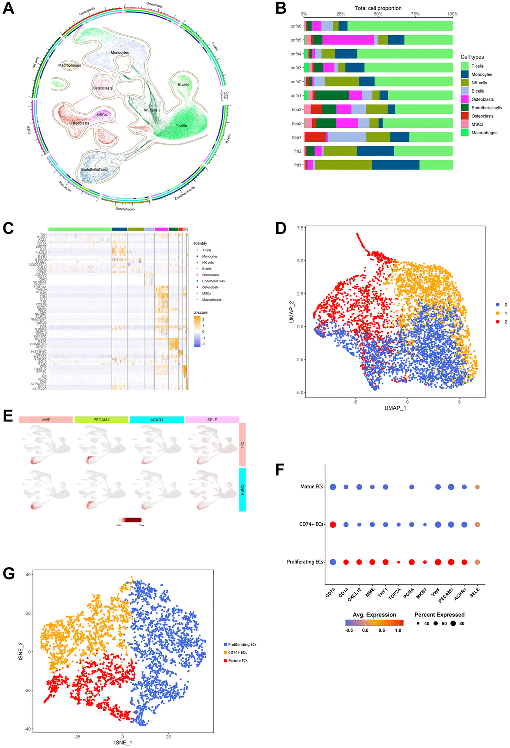 scRNA-seq was used to analyze and identify different cell types and EC clusters. (A) Cell type annotation of 9 clusters. (B) The percentage of clusters and cell types in each sample was represented on a proportion chart. (C) The heat map shows the top 10 marker genes in each cluster. (D) Two-dimensional plots of UMAP dimensionality reduction of the ECs. (E) ECs signature genes embedded on t-SNE dimension reduction map. (F) Dot plot showing marker genes for ECs subtypes. (G) tSNE shows the color-coded clustering for ECs.
