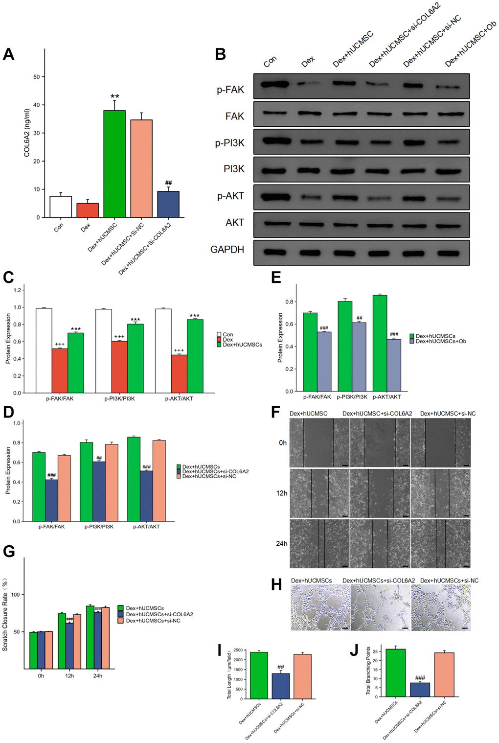 hUCMSCs played a protective role by regulating FAK/PI3K/AKT signaling pathway through COL6A2. (A) COL6A2 levels in the cell supernatants, assessed via ELISA. (B–E) The protein level of p-FAK, FAK, p-PI3K, PI3K, p-AKT, AKT and GAPDH in BMECs by Western blot. (F) Wound healing assay at 0, 12, and 24 h after co-culture with hUCMSCs. (G) Scratch closure rate in three groups. (H) Tube formation assay at 12 h after co-culture with hUCMSCs. (I, J) Total length and Total branching points in three groups. The data are presented as the means ± SD (n = 3). +p ++p +++p *p **p ***p #p ##p ###p 