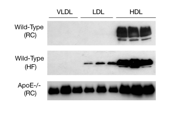 ApoD distribution in lipoproteins