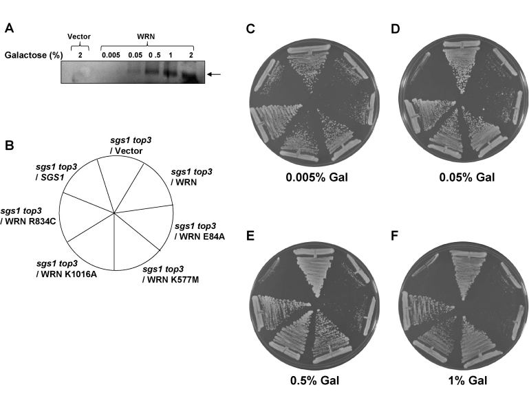 WRN mediated restoration of slow growth phenotype in sgs1 top3 background is independent of its expression level