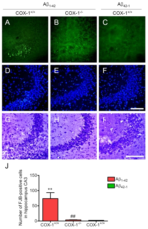 Increased degenerating neurons in the hippocampus 7 d after