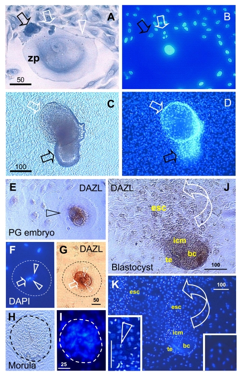  Oocyte and parthenote development in vitro. (A) The oocyte development in OSC culture is accompanied by a satellite (black arrow) and neuronal (white arrow) cells. White arrowhead indicates neuronal extension. (B) DAPI staining of (A). (C) The parthenote shows a blastocoele (white arrow) and inner cell mass (black arrow). (D) DAPI staining of (C). Four cell embryo. (E - G) and morula (H and I). J and K panels show a blastocyst consisting of blastocoele (bc), trophectoderm (te), and inner cell mass (icm) releasing ESC (esc). Left insert in panel K shows enhanced DAPI staining of dividing ESC vs. low DAPI staining of other cells in the culture (right insert). Details in text. Adapted in part from Ref. [137], © Cambridge Journals. 