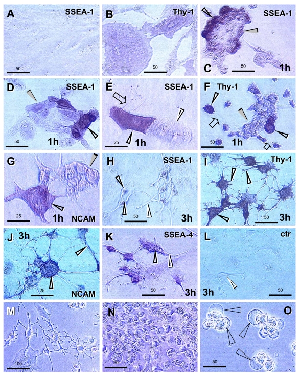  Human ovarian epithelial stem cell cultures (representative images from four experiments): untreated (A and B); pre-treated for 1 day with E2 and 1h after TP+PG treatment (C-G); pre-treated for 1 day with E2 and 3h after TS+PG treatment (H-O). Lack of SSEA-1 expression (A) and moderate Thy-1 expression by some epithelial cells (B). SSEA-1 is strongly expressed in some small cells resembling stem cells (black vs. white arrowheads, C and D) and one of the cells originating by asymmetric division (E). Similar cells show strong expression of Thy-1 (F). The NCAM expression was also detected in some cells (G). Two hours later, the cells reached neuronal morphology and exhibited SSEA-1 expression in the cell bodies but not extending processes (H, black vs. white arrowheads), Thy-1 and NCAM expression in both (I and J, black arrowheads), and SSEA-4 expression slightly exceeding that of SSEA-1 (K vs. H). No staining was observed in the immunohistochemistry control (L). Panels M-O show phase contrast microscopy with neuronal and epithelial cells (M), floating numerous putative NSC (N), and putative NSC exhibiting bubble type anchors (arrowheads, O). Numbers above bars indicate microns. For details see text. Adapted from Ref. [138], © Landes Bioscience. 