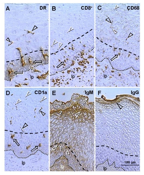 Uterine ectocervix immunohistochemistry as indicated above columns