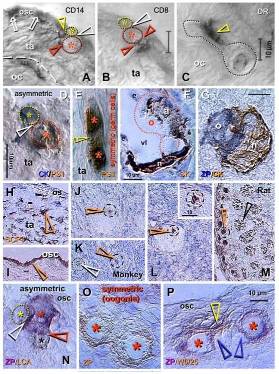  Origin of new oocytes (neo-oogenesis), primordial follicles, and SCP3 expression in adult human and monkey ovaries (A-M), and oogenesis in adult rat ovaries (N-P). (A) During asymmetric division (white arrowhead), the CD14 MDC interact with both the OSC daughter (yellow arrowhead) and germ cell daughter (red arrowhead). (B) T lymphocytes, however, interact with the germ cell daughter only (red arrowheads). (C) Ameboid germ cells (dotted line) migrating through the dense ovarian cortex (oc) are accompanied by activated MDC (arrowhead). (D) Asymmetrically dividing OSC produce a new PS1+ germ cell (red asterisk) and CK+ progenitor cell (yellow asterisk). (E) In the tunica albuginea (ta) germ cells (asterisks) symmetrically divide (arrowhead). (F) Capture of oocyte (o) from the blood circulation by an arm (a) of granulosa cell nest (n) lining the venule lumen (vl); e, endothelial cells. (G) Oocyte nest assembly. (H) Segments of tunica albuginea (ta) in ovaries with follicular renewal (early luteal phase) showed strong SCP3 expression of mesenchymal (arrowheads) OSC precursors under ovarian surface (os). (I) Staining of OSC (osc and arrowhead) was apparent in other segments - note lack of staining of tunica albuginea under developed OSC. (J) Postovulatory human ovaries showed staining of oocyte nucleoli (arrowhead) in some primordial follicles. (K) In monkey ovaries, similar staining of oocyte nucleoli in some primordial follicles was observed (red vs. white arrowhead). (L) Staining of paired chromosomes oocyte was observed in human ovaries (inset shows higher magnification). (M) Adult rat testis (positive control) showed staining of condensed chromosomes in spermatogonia (red arrowhead) and progression of meiotic division in primary spermatocytes (black arrowhead). Oogenesis in adult rat ovaries is initiated by asymmetric division of OSC (white arrowhead, N) showing unstained OSC daughter (yellow asterisk) and ZP+ (magenta color) germ cell daughter (red asterisk) accompanied like in human ovaries by a lymphocyte (black asterisk and brown color). Symmetric division of ZP+ oogonia (asterisks, O) follows, and is accompanied (P) by MDC (yellow arrowhead). Blue arrowheads in (P) indicate association of primitive granulosa cells with this process. ZP, zona pellucida; LCA, leukocyte common antigen; W6/25, marker of rat MDC. Details in text. Adapted A-C from Ref. [57], © Blackwell Munksgaard, D-G from Ref. [35], © Antonin Bukovsky, H-M from Ref. [71], © Landes Bioscience, N-P from Ref. [72], © Landes Bioscience. 