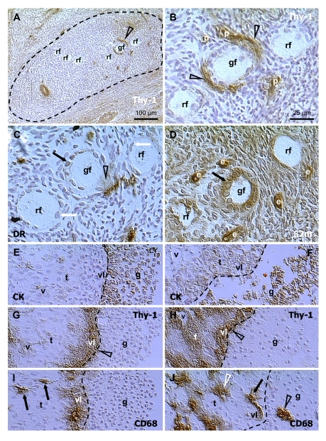  Selection of secondary (A-D) and preovulatory (dominant) follicles (E-F) in the adult human ovary. Staining for Thy-1, HLA-DR (DR), MHC class I light chain (β2m), cytokeratin 18 (CK) and CD68 of mature MDC, as indicated in panels. Dashed line in (A) indicates an area exhibiting diminution of Thy-1 expression by stromal cells. (B), detail from (A). (C) and (D) are semi-parallel sections to (B). Dashed line in (E-J), follicular basement membrane. rf, resting follicles; gf, growing follicle; p, pericytes; e, endothelial cells; v, microvasculature in theca interna (t); vl, vascular layer adjacent to the follicular basement membrane; g, granulosa layer. Details in text. Adapted from Ref. [70], © Wiley-Blackwell. 