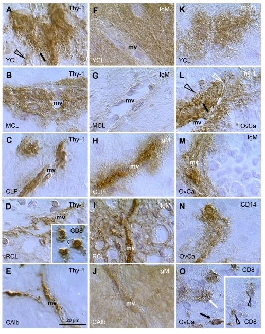  Staining for Thy-1, IgM, CD8, and CD14, as indicated in panels, in human corpora lutea and ovarian adenocarcinomas (OvCa). YCL, young CL; MCL, mature CL; CLP, CL of pregnancy; RCL, regressing CL (subsequent follicular phase); CAlb, corpus albicans. mv, microvasculature. Scale bar in E applies to panels A-O, including insets. Details in text. Adapted from Ref. [109], © Elsevier. 
