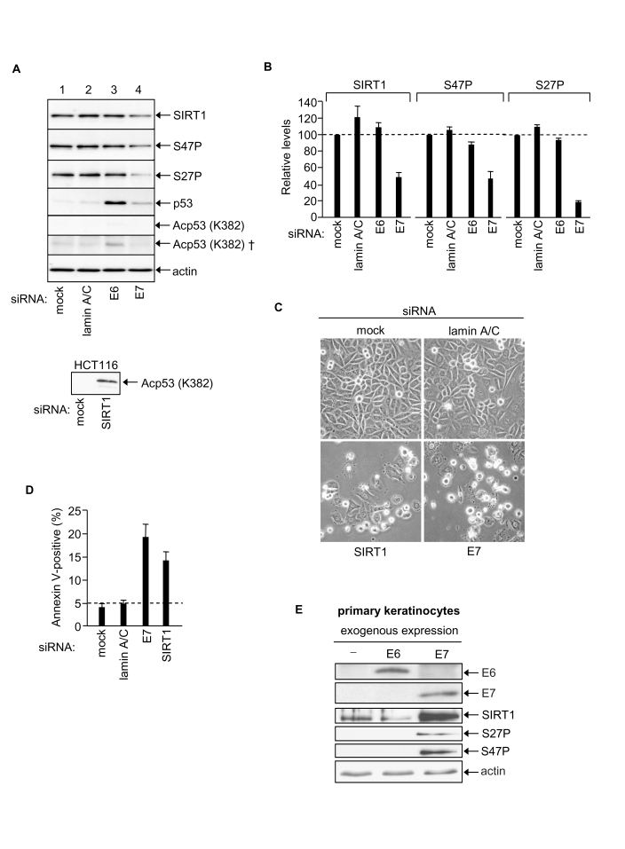 HPV E7 enables SiHa cervical cancer cell survival via up-regulation of SIRT1 protein levels