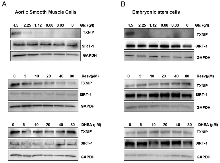 Effects of limited glucose availability, resveratrol and DHEA on expression of TXNIP and Sirt1 in normal cells