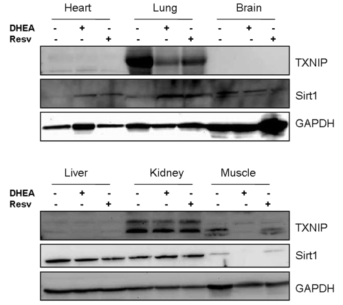 Tissue distribution of Sirt1 and TXNIP in mice and their regulation by resveratrol and DHEA