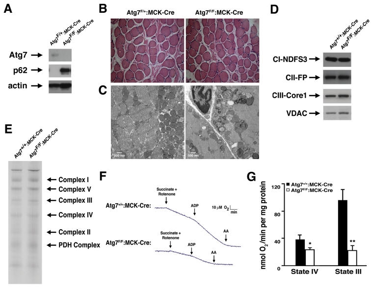 Impaired mitochondrial function in Atg7 deficient skeletal muscle