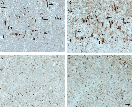  In another AD case, age 63, adjacent hippocampal tissue sections demonstrate many of the AD-related pathological structures (arrows) containing pMcm2 (A) are also positive for hyper-phosphorylated tau (B) in the CA1 region. Lower magnification of adjacent sections of the subiculum shows the large number of NFT and plaques recognized by pMcm2 (C) and AT8 (D). * denotes landmark vessel. Scale bars= 50 μm (A,B), 100 μm (C,D). 