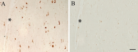  Pretreatment with alkaline phosphatase to remove phosphate groups, results in elimination of pMcm2 reactivity (B) compared to an untreated adjacent serial section of an AD case (A). * denotes landmark vessel. Scale bar = 50 μm. 