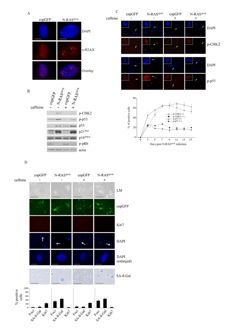 Oncogenic N-RAS Q61K induces DNA damage response in human melanocytes