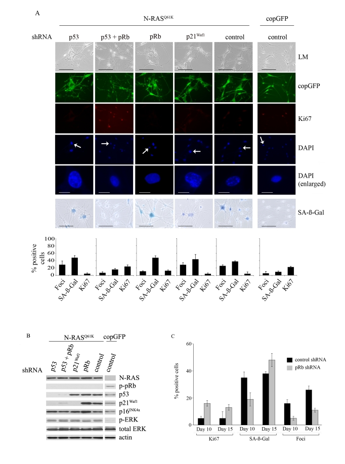 Relative contributions of the p53 and pRb tumour suppressor pathways in N-RAS Q61K-induced melanocyte senescence