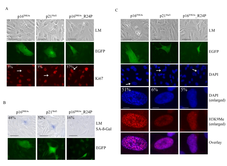 Impact of p16 INK4a or p21Waf1 expression on the cellular senescence program