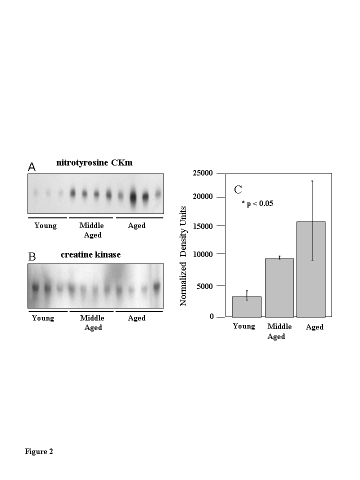 Muscle creatine kinase (CKm) is differentially 3-nitrotyrosine modified during aging