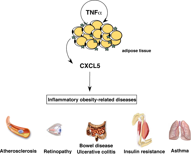 Role of CXCL5 in inflammatory obesity-related pathologies