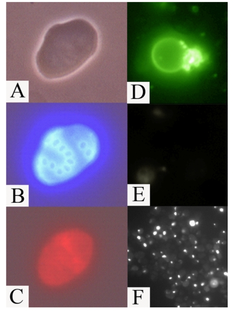 Apoptotic markers in old mother cells (fraction V) of the mutant afo1Δ strain. (A) phase contrast; (B) same cell as in A stained with Calcofluor White M2R; (C) the same cell stained with DHE indicating a high level of ROS; (D) an old mother cell stained with FITC-annexin V revealing inversion of the plasma membrane; (E) the same cell as in (D) shows absence of staining with propidium iodide revealing intact plasma membrane; (F) TUNEL staining of old afo1Δ cells. 