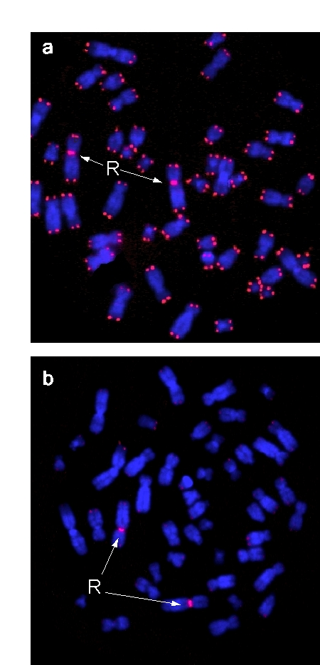 Metaphases of phytohemagglutinin-stimulated peripheral blood lymphocytes