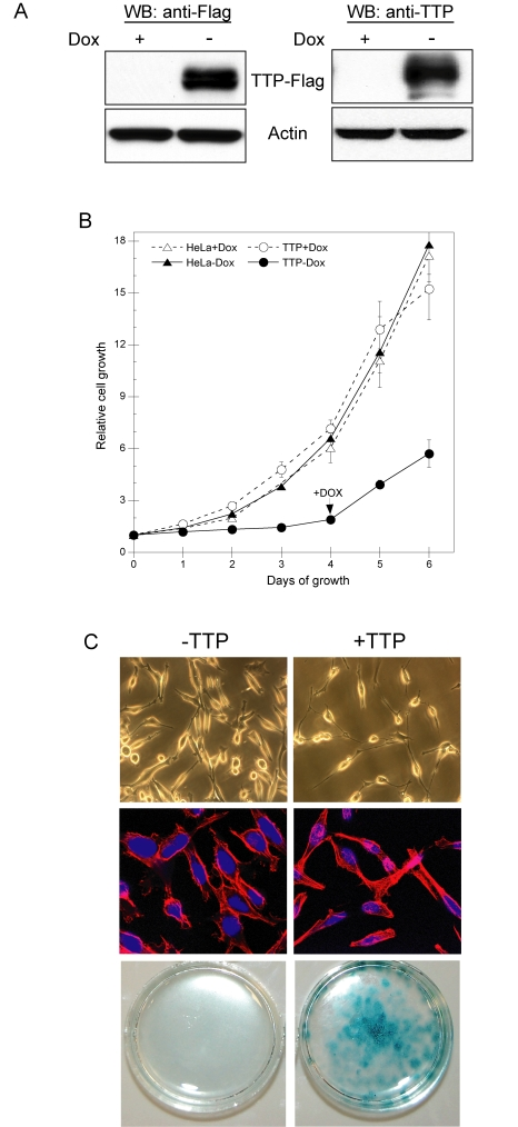 TTP inhibits HeLa cell proliferation through induction of senescence