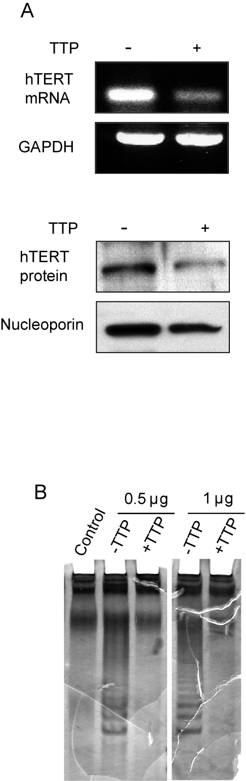 TTP-mediated inhibition of hTERT expression