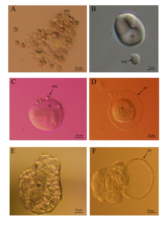Ovarian surface epithelium stem cells and in vitro developed
                                                                        oocyte-like cells in postmenopausal women. (A) Putative stem
                                                                cells proliferating and growing in the cluster of scraped OSE cells
                                                                (inverted microscope, Hoffman illumination, magnification 400x). (B)
                                                                Putative stem cell and erythrocyte (inverted microscope equipped with Nikon
                                                                Digital Sight DS-Ri1 camera, DIC-Nomarski illumination, magnification
                                                                6000x).  (C) Oocyte-like cell without zona pellucida with attached
                                                                putative stem cells possibly acting as granulosa cells (inverted
                                                                microscope, Hoffman illumination, magnification 200x). (D) Oocyte-like
                                                                cell with zona pellucida-like structure attached to the dish bottom
                                                                (inverted microscope, Hoffman illumination, magnification 200x). (E)
                                                                Blastocyst-like structure with blastocoel-like cavity at the beginning of "hatching"(inverted microscope, Hoffman illumination, magnification
                                                                100x). (F) Blastocyst-like structure after "hatching"
                                                                (inverted microscope, Hoffman illumination, magnification 100x) (images: University
                                                                        Medical Centre Ljubljana, 2009).
                                            