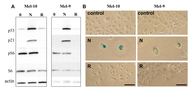 Effects of nutlin-3a and rapamycin on melanoma cells