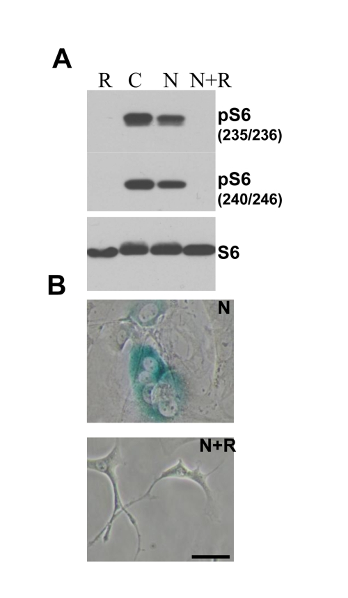 Effect of rapamycin on nutlin-induced senescence in melanoma cells . (A