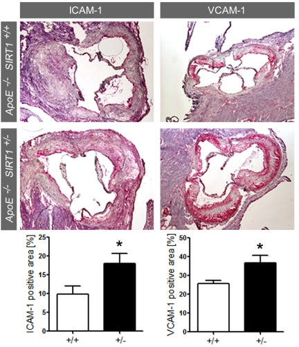  ICAM-1 and VCAM-1 staining and quantification in plaques from aortic sinus. Magnifications: X40. ApoE-/- SIRT1+/+ (+/+, n=6, white columns) and ApoE-/- SIRT1+/- (+/-, n=6, black columns). *p