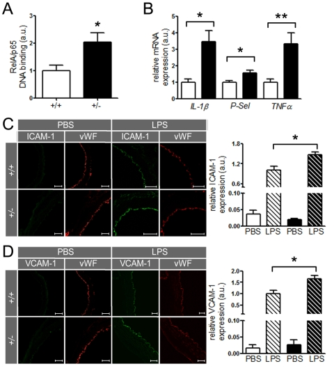 SIRT1 prevents expression of endothelial adhesion molecules