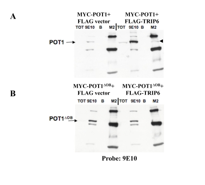 POT1 interacts with TRIP6 in transient transfections