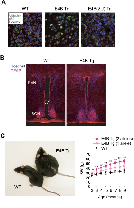  E4B transgenic (Tg) mice as a new obesity model with hypothalamic neurodegeneration. (A) Immunofluorescence analysis of the PVN region of 6-month-old wild-type (WT) or E4B(ΔU) Tg mice and of a 4-month-old E4B Tg mouse. Brain slices were stained with antibodies to polyubiquitin (green) and to p62 (red), and nuclei were stained with Hoechst 33258 (blue). Protein aggregates reacted with both types of antibody in the PVN region of E4B Tg mice, but not in that of WT or E4B(ΔU) Tg mice. (B) Immunofluorescence analysis of the PVN region of 10-week-old WT or E4B Tg mice with antibodies to glial fibrillary acidic protein (GFAP, red). Nuclei were stained with Hoechst 33258 (blue). SCN and 3V indicate the suprachiasmatic nucleus and third ventricle, respectively. The number of GFAP-positive glial cells in and around the PVN was increased in E4B Tg mice, indicative of gliosis associated with neurodegeneration. (C) Obesity in E4B Tg mice. The gross appearance of an E4B Tg mouse and a WT littermate at 9 months of age is shown on the left. The time course of body weight (BW) for WT mice and E4B Tg lines harboring one or two alleles of the transgene is shown on the right. The extent of obesity in the Tg animals harboring two alleles of the transgene was about twice that in littermates harboring only one allele, indicating that the obese phenotype is directly related to the expression level of the transgene. *P P 
