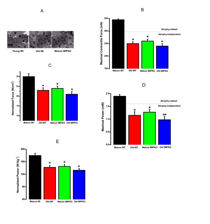 Evidence for muscle atrophy, decreased contractile force, and reduced power in skeletal muscles suggested similarity from old WT and MIPKO mice