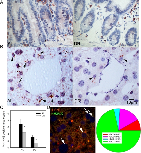 DR decreased lipid peroxidation in liver