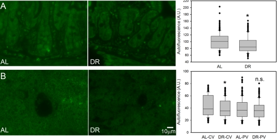 DR decreased the intensity of broad-band autofluorescence